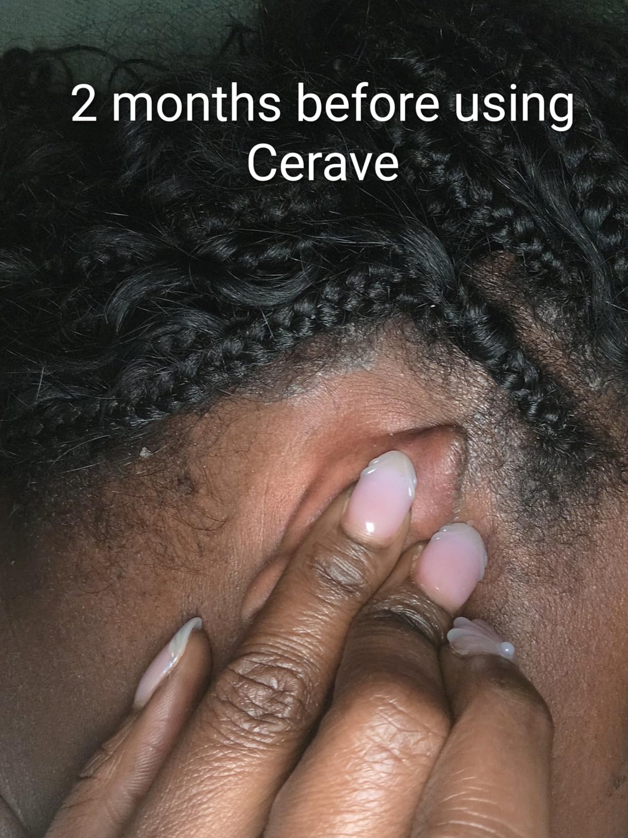 CeraVe Hydrating Anti Dandruff Shampoo, 1% Pyrithione Zinc Dandruff Treatment With Ceramides, Niacinamide & Hyaluronic Acid, Helps Eliminate Flakes & Provides Itchy Scalp Relief, Sulfate Free, 12 Oz customer photo 2