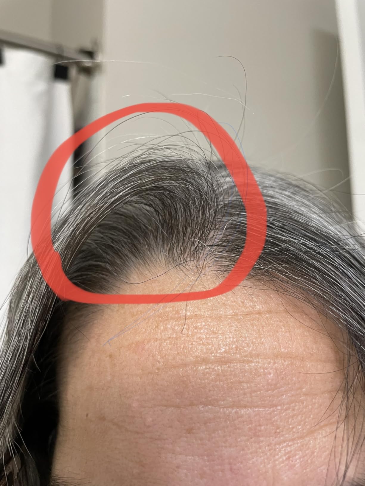 Root Lifting Flat Iron | Alternative to Volumizing Sprays and Powders | Hair Volumizing | Patent Pending Design | Great for Fine and Short Hair customer photo 2
