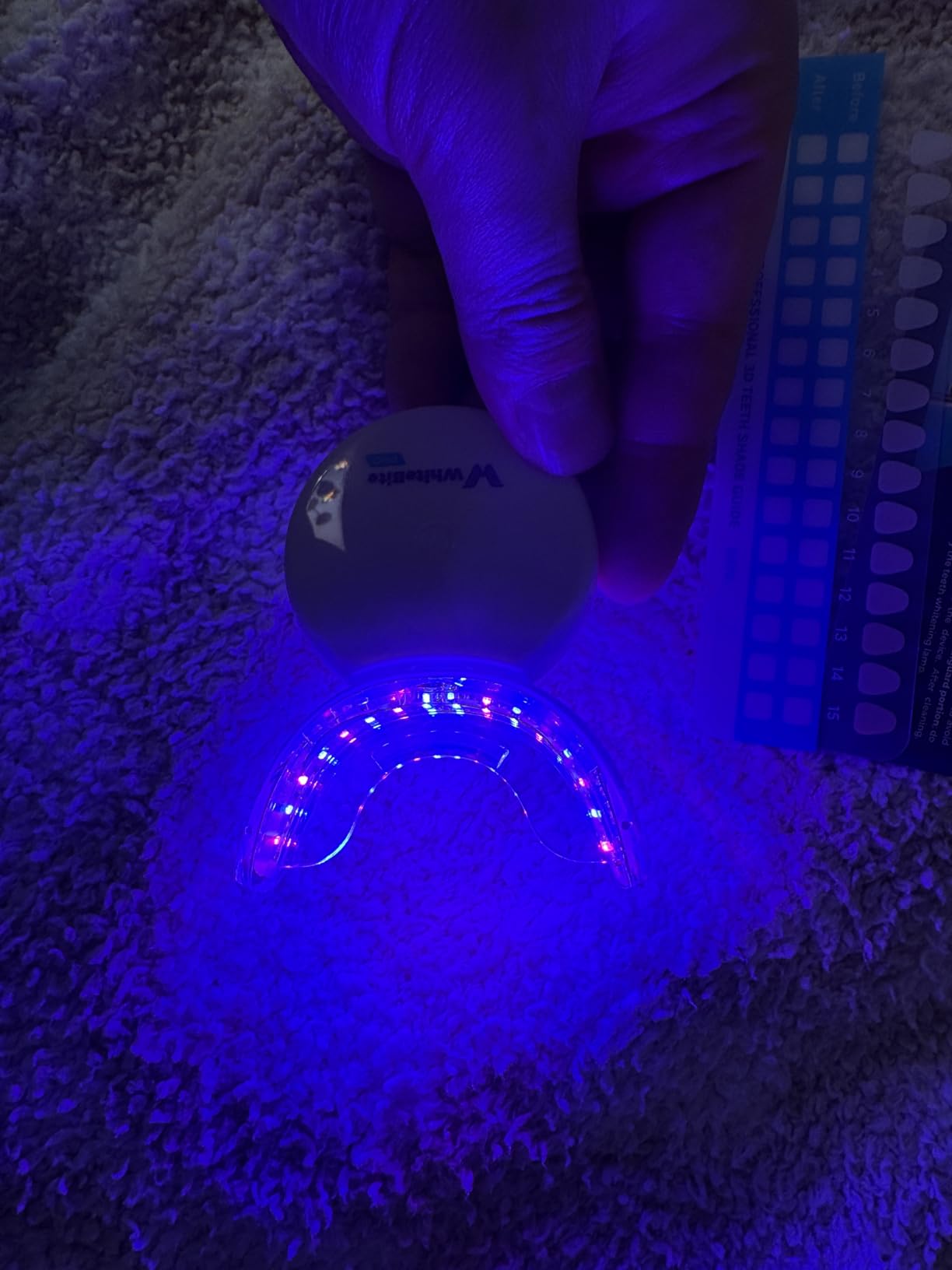 Whitebite Pro Teeth Whitening Kit for Sensitive Teeth - 32X LED Light + 35% Carbamide Peroxide Gel + Remineralizing Gel | Dental-Grade Whitening at Home customer photo 2