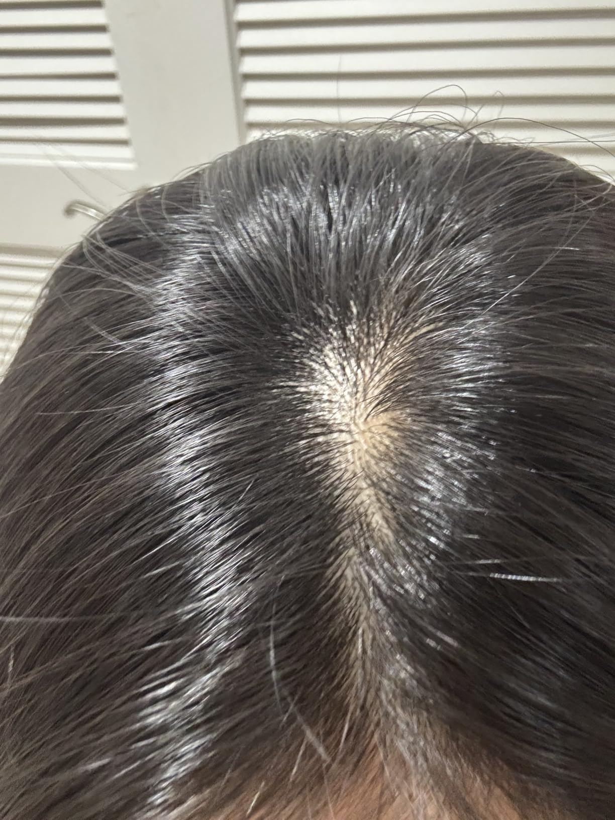 lilyeve GROWTURN Exosome Hair Growth Serum with Built-In Brush, 3.38 fl oz | Built-In Brush Serum with Biotin, Caffeine & Peptides for Thinning & Flat Hair, Non-Greasy & Fragrance-Free, Korean Hair Care customer photo 2
