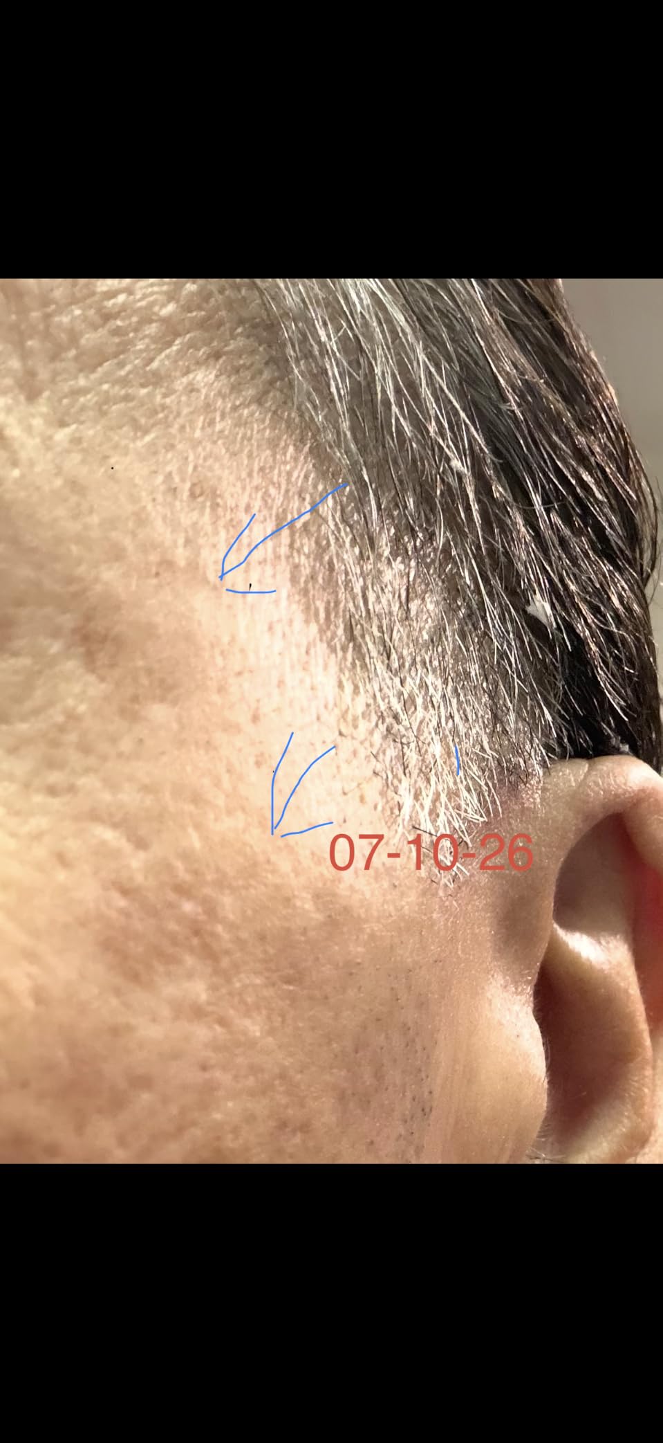 3-Step Dark Spot & Fine Lines System - Korean Skincare for Dark Spots, Wrinkles & Dull Skin - Facial Treatment with Tranexamic Acid, Niacinamide, Bakuchiol, Vitamin C & Centella customer photo 2
