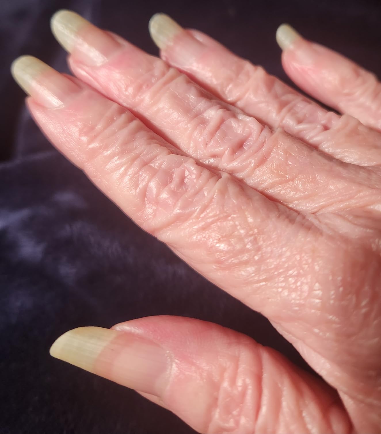 Sally Hansen Vitamin E Nail & Cuticle Treatment Pen, Hydrates and Conditions Dry Nails, Nourishing Formula with Apricot Oil customer photo 2