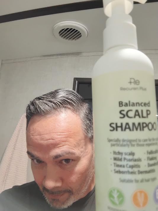 Antifungal Shampoo for Folliculitis and Seborrheic Dermatitis: Scalp Psoriasis Treatment with Salicylic Acid, Piroctone Olamine, Rosemary & Coconut Oil 8.8 fl.oz customer photo 2