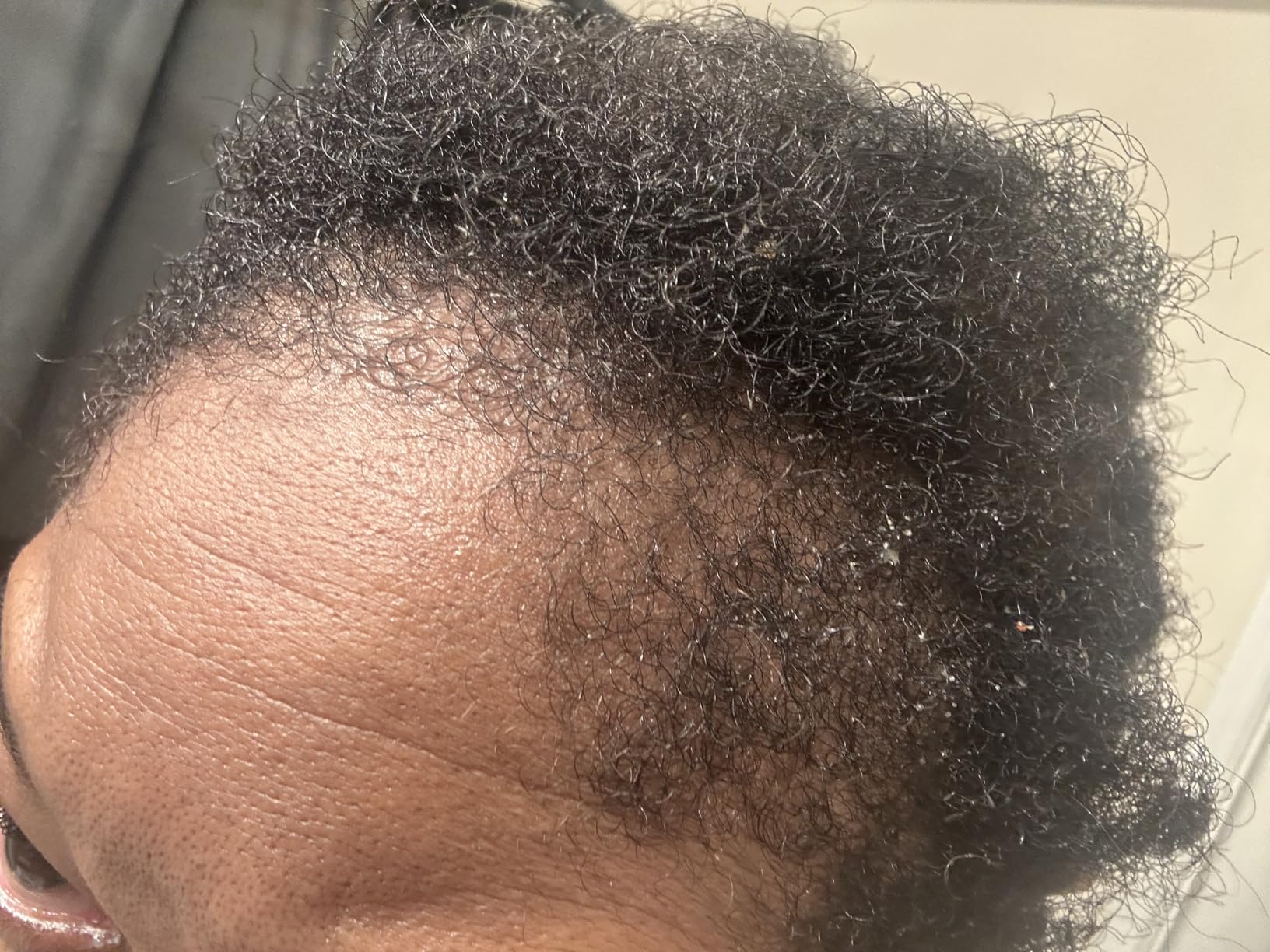 Hair Growth Spray with Peptide: Infused with Caffeine, Rosemary and a Rich Blend of Nourishing Plant Extracts to Strengthen, Revitalize, and Promote Fuller Hair 3.38FL OZ/100ML customer photo 1