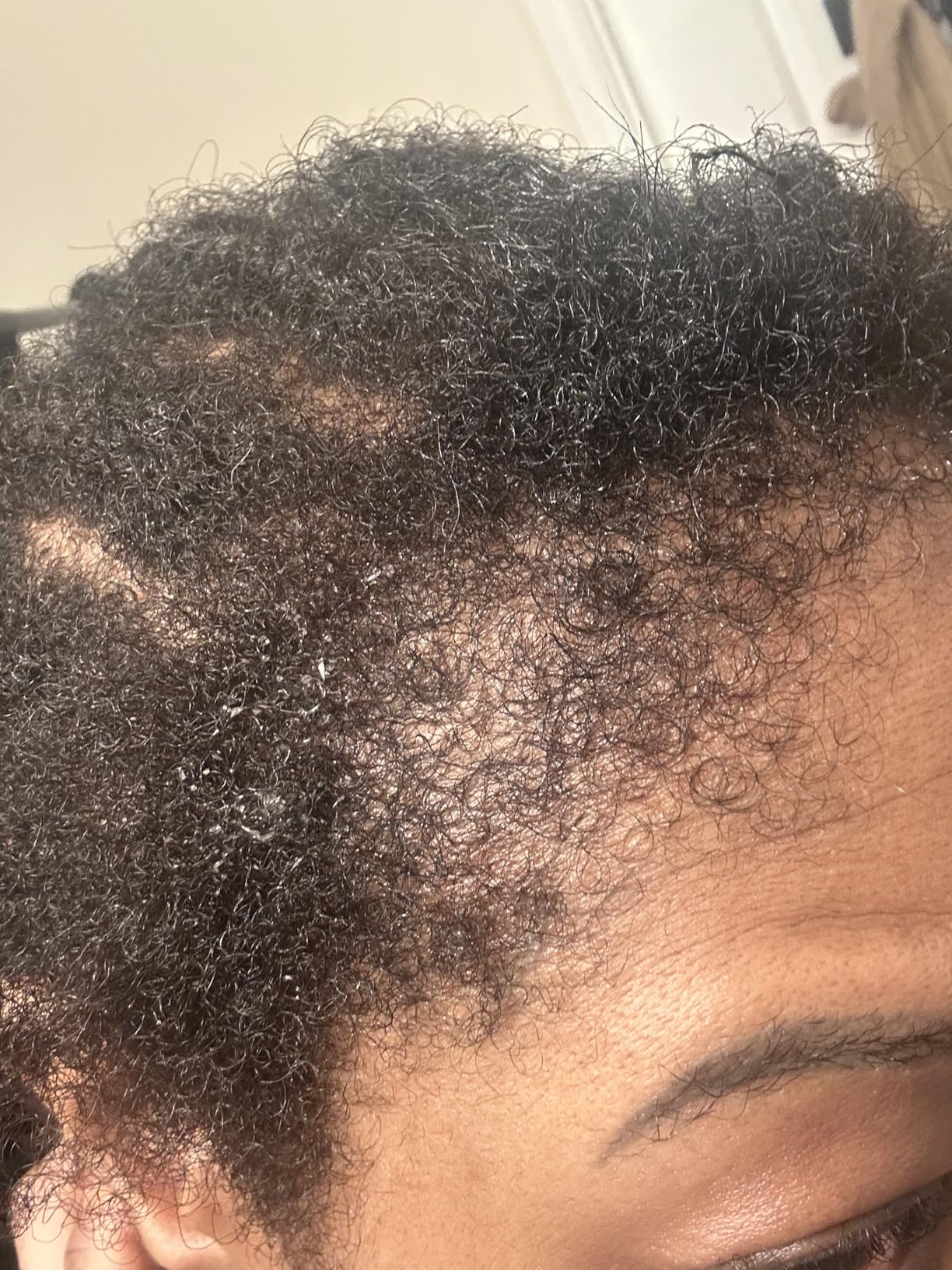 Hair Growth Spray with Peptide: Infused with Caffeine, Rosemary and a Rich Blend of Nourishing Plant Extracts to Strengthen, Revitalize, and Promote Fuller Hair 3.38FL OZ/100ML customer photo 2