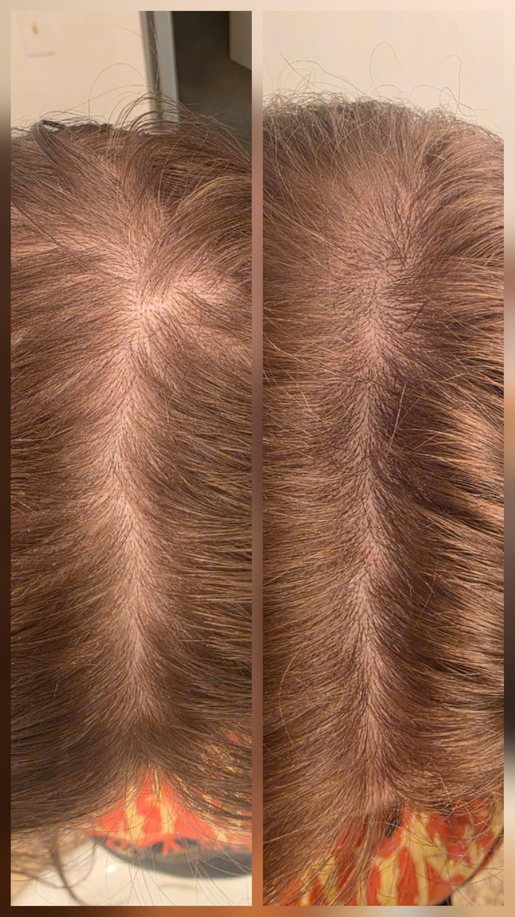 Hair Growth Supplements for Women for Thicker, Fuller Hair, Nourishes Thinning & Loss, with Proprietary Collagen Complex customer photo 1