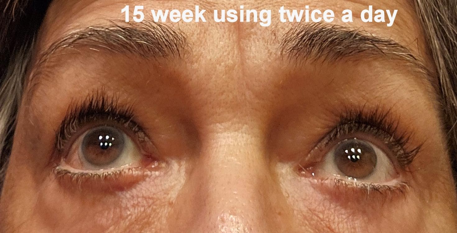 Advanced Eyelash Serum for Thicker, Longer Eyelashes and Eyebrows - Grow Luscious Lashes with Brow Enhancer (3mL) customer photo 1