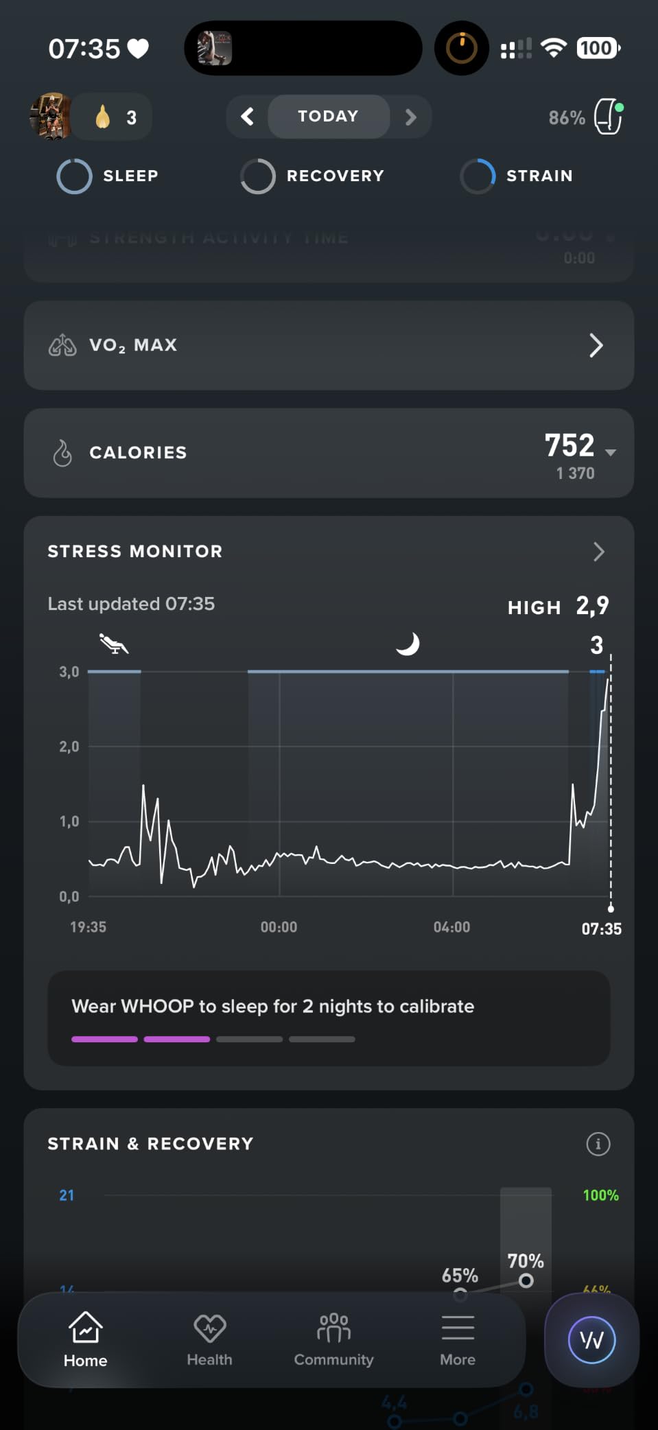 WHOOP 5.0/MG Activity Tracker - 12 Month Membership - Health and Fitness Wearable - 24/7 Activity and Sleep Tracker, Personalized Coaching, Menstrual Cycle Insights - 14+ Days Battery Life customer photo 1