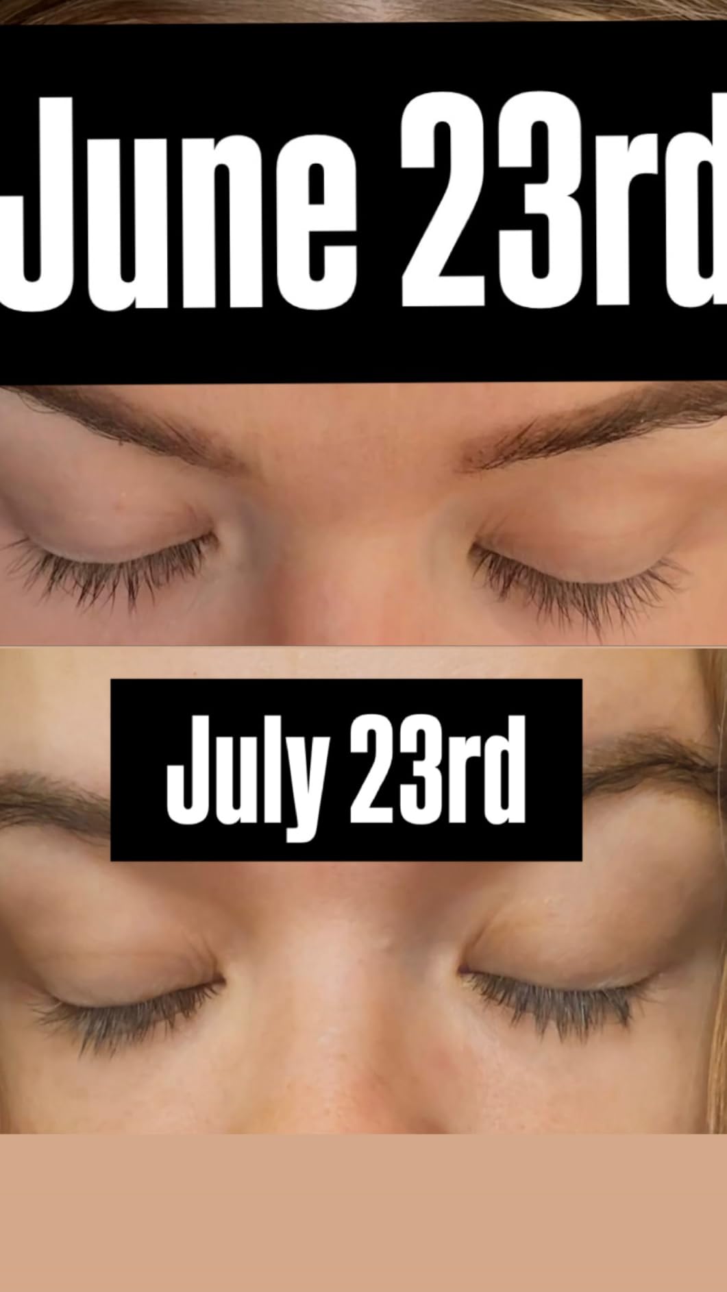 Lash Serum for Eyelash Growth, Premium Lash Enhancing Serum with Advanced Formula Volumizing Longer Fuller and Thicker Looking Lashes, Eyelash Growth for Sensitive Eyes (5 mL) customer photo 2