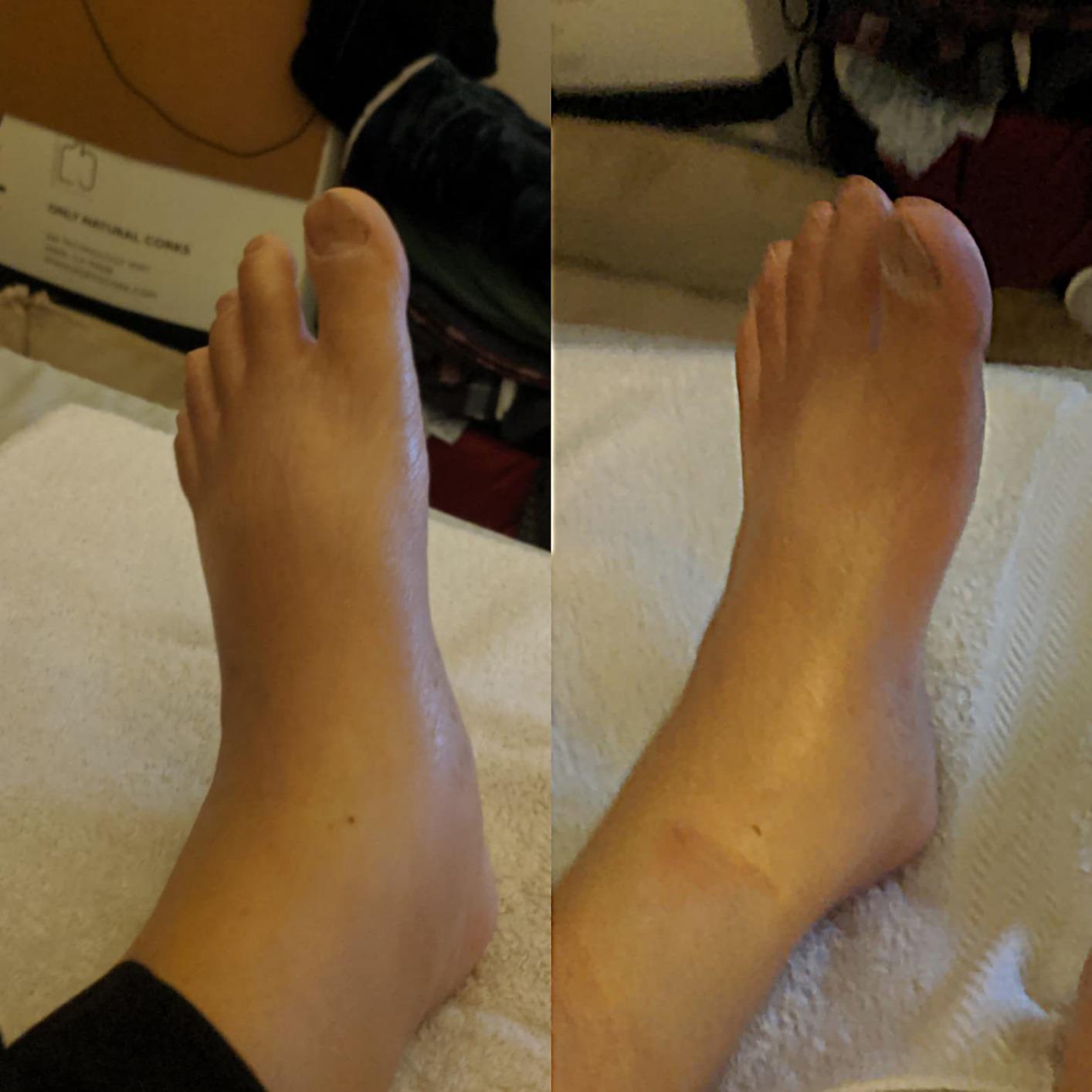 FIT KING Foot and Leg Massager for Circulation and Relaxation customer photo 1