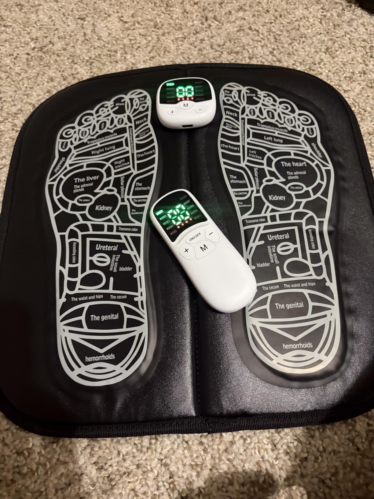 Transcutaneous Electrical Nerve Stimulator for Pain Relief,EMS Foot Stimulator Temporarily Reduce Lower Extremity Pain, EMS Foot Massager for Increase Local Blood Circulation. customer photo 1